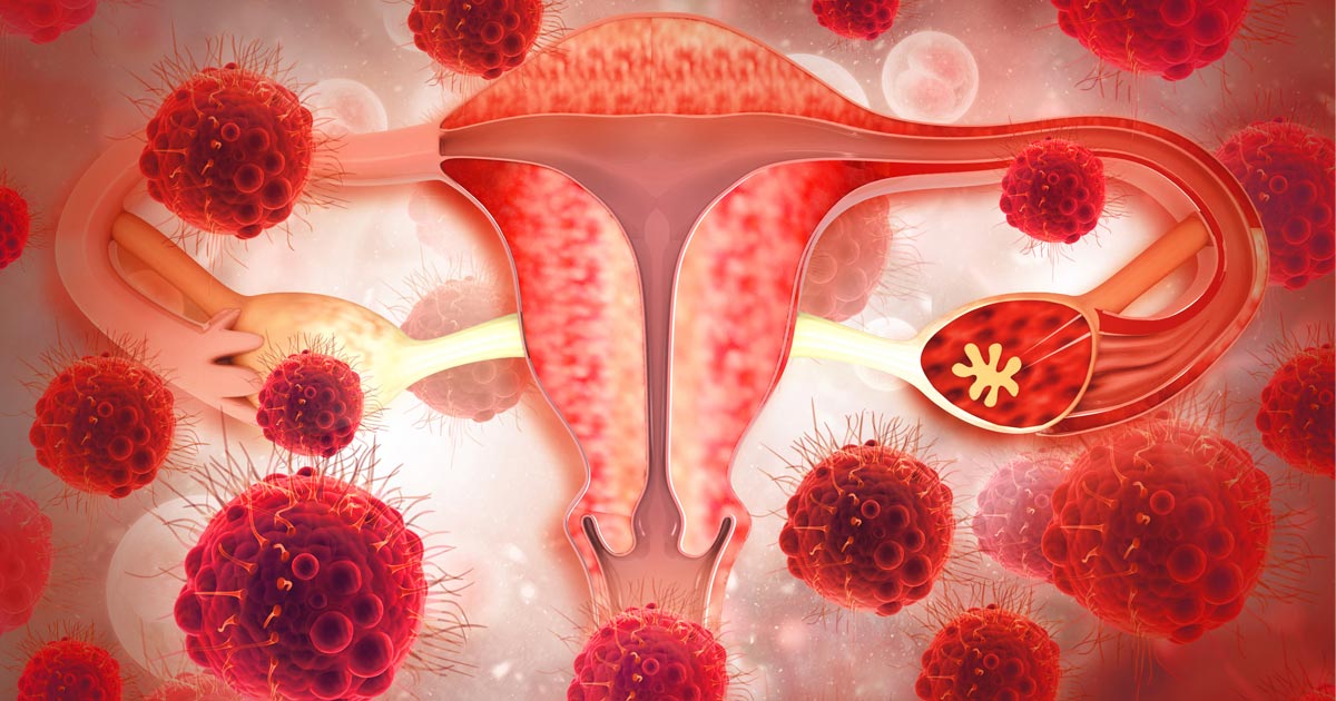 Image of uterus and ovaries