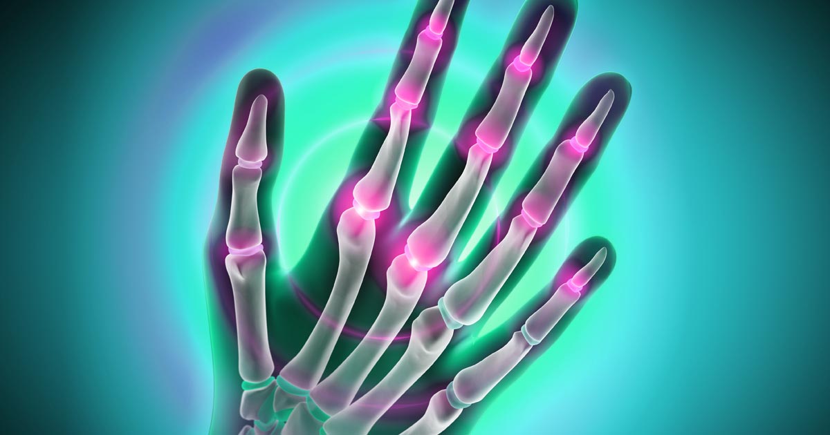 一个X射线像一只手的图像，在蓝色背景上用一些霓虹灯粉红色突出疾病