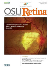 眼科手术，激光和视网膜成像